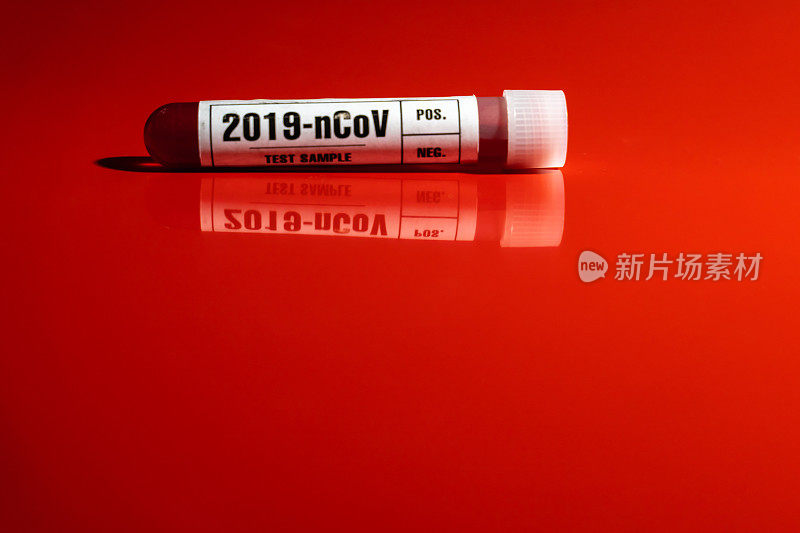 2019-nCoV (COVID-19)血液检测样管特写白标，红色背景